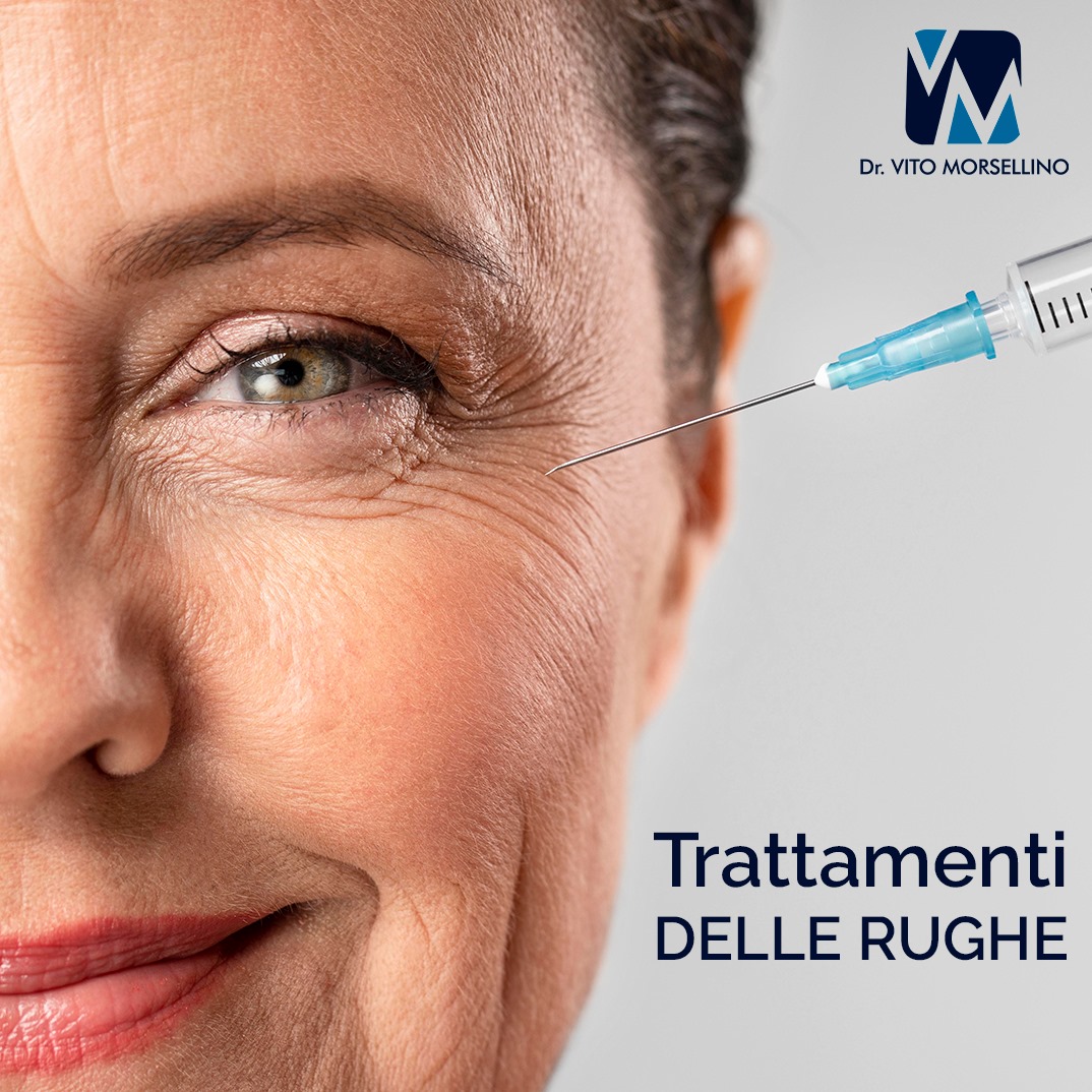 Trattamento rughe botox